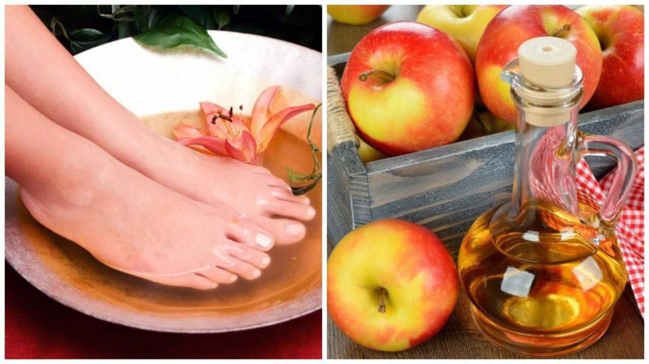 Vinagre de manzana para los pies